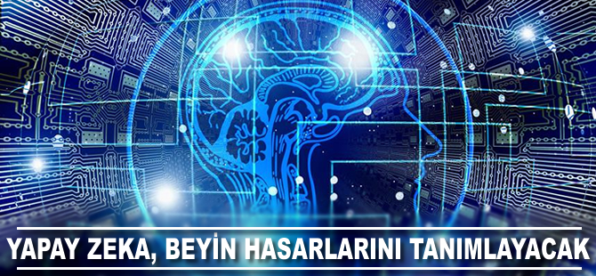 Yapay zeka beyin hasarlarını tanımlayacak